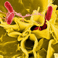 infection-bacterienne-salmonella-non-typhique